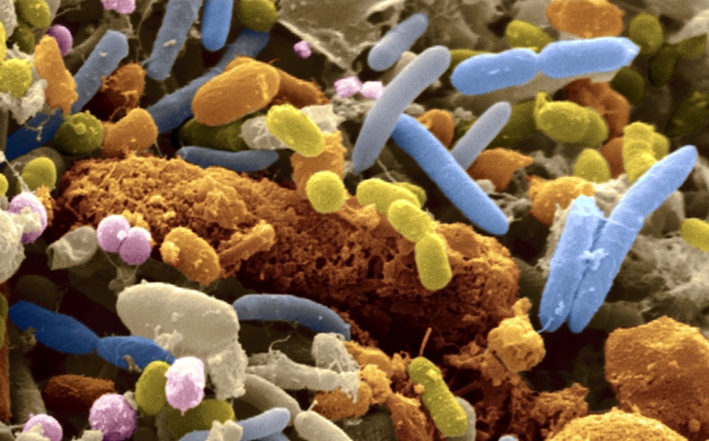 Устойчивость бактерий к антибиотикам стала третьей самой распространенной причиной смертности в мире