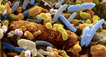 Устойчивость бактерий к антибиотикам стала третьей самой распространенной причиной смертности в мире