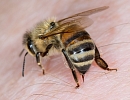 Лечение аденомы простаты прополисом и пчелами